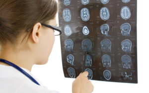 doctor examining a brain cat scan